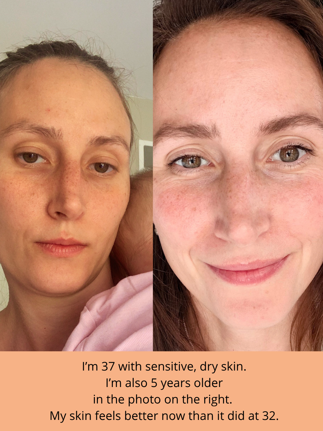 The Meadow- Deep Hydration, Smoother Skin & Natural Radiance